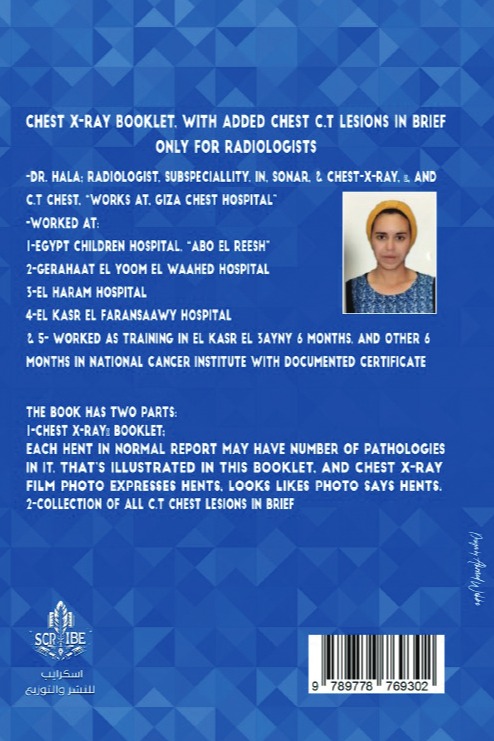 Chest X-Ray Booklet, with added Chest C.T Lesions in brief Only for Radiologists