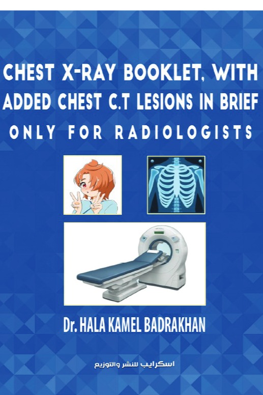 Chest X-Ray Booklet, with added Chest C.T Lesions in brief Only for Radiologists