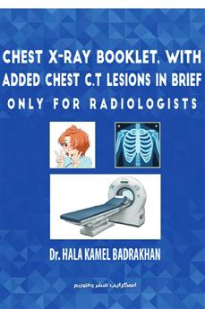 Chest X-Ray Booklet, with added Chest C.T Lesions in brief Only for Radiologists